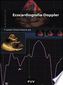 Ecocardiografía-Doppler