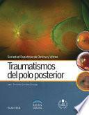 Traumatismos del polo posterior